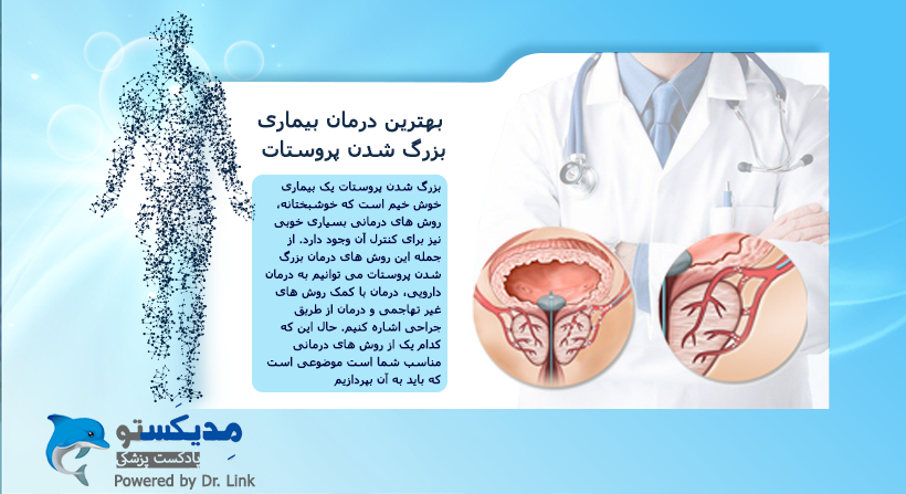   دکتر لینک | بهترین درمان بیماری بزرگ شدن پروستات 