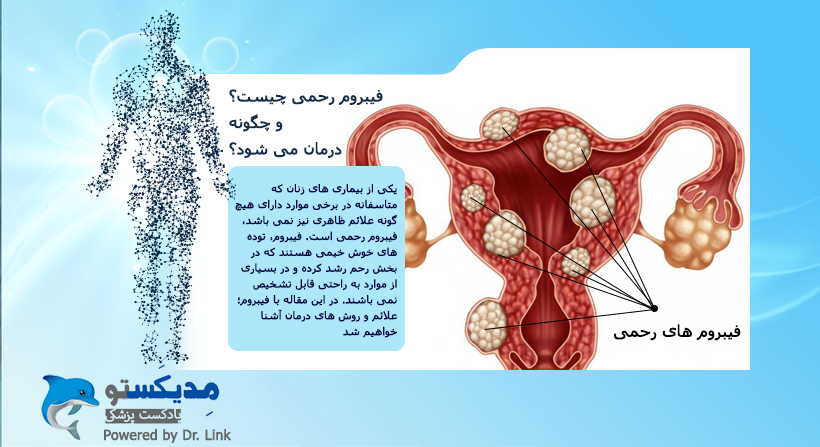 فیبروم رحمی چیست و چگونه درمان می شود؟