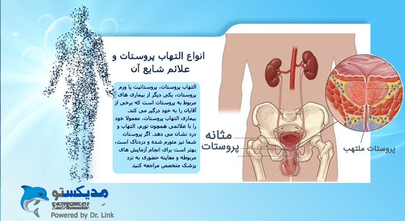 انواع التهاب پروستات و علائم شایع آن