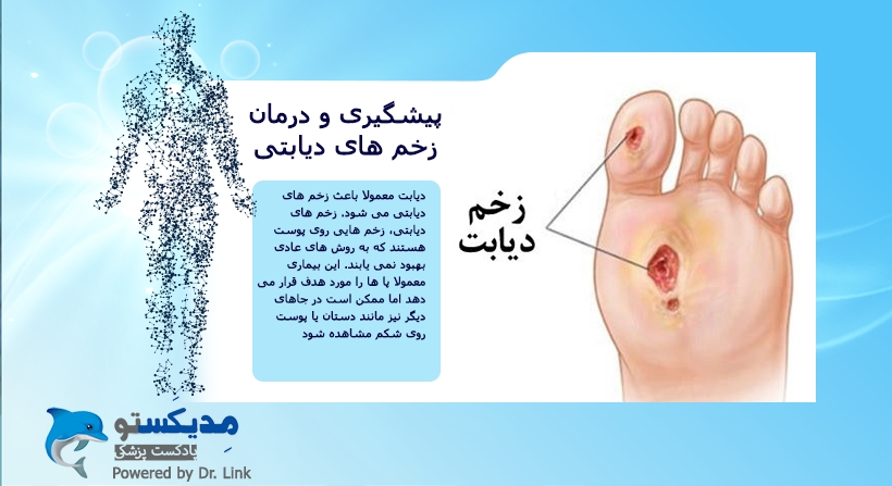 پیشگیری و درمان زخم های دیابتی